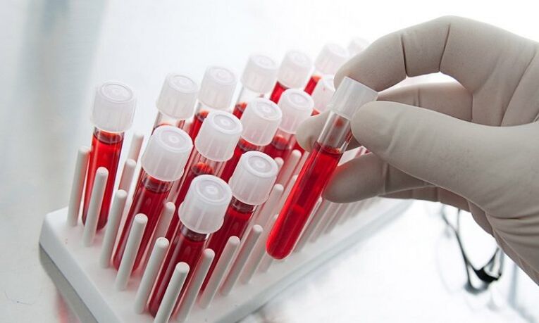 blood in test tubes for testing a dog with prostatitis